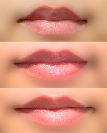 皮剥けは治るのか…？一晩寝かせた結果