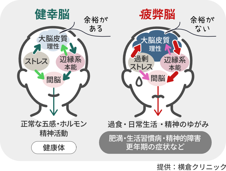 更年期に、心身共に健やかな状態でいられるためには脳が健康であることが大切